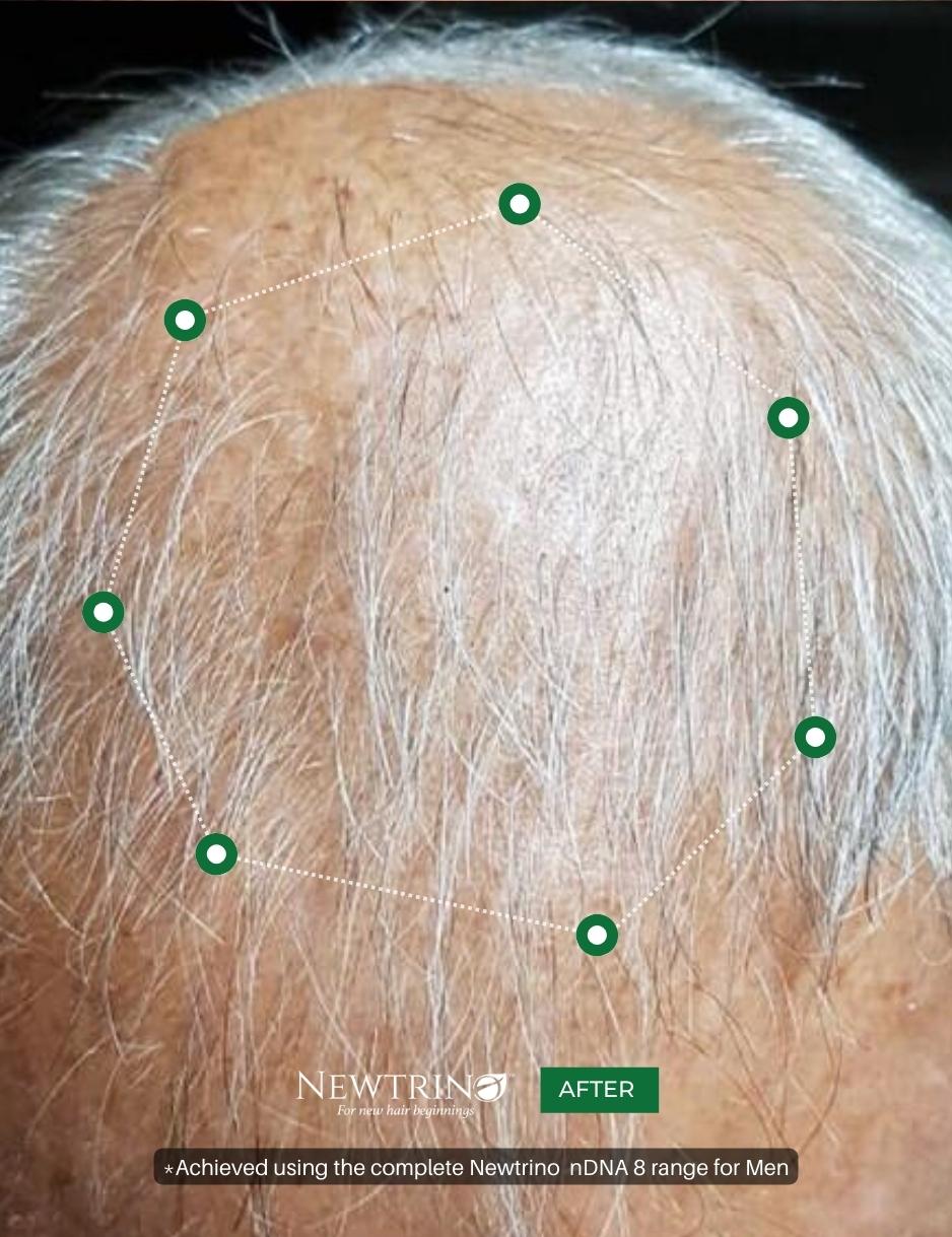 Densifying Starter kit for Men (100ml) - Newtrino International